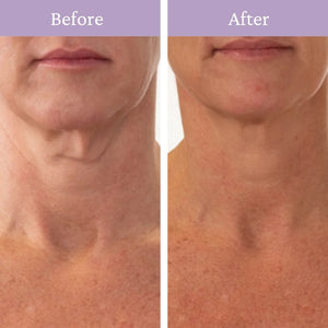 Ageless Throat & Decolletage Crème