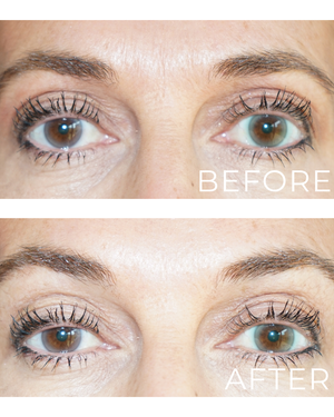 Ageless Eye Tight Uplift Serum