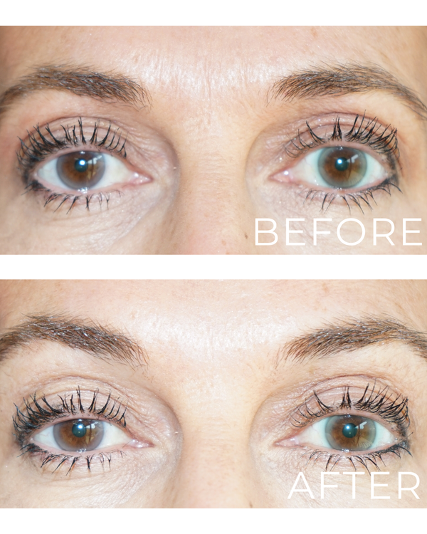 Ageless Eye Tight Uplift Serum