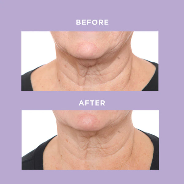 Ageless Throat & Decolletage Crème
