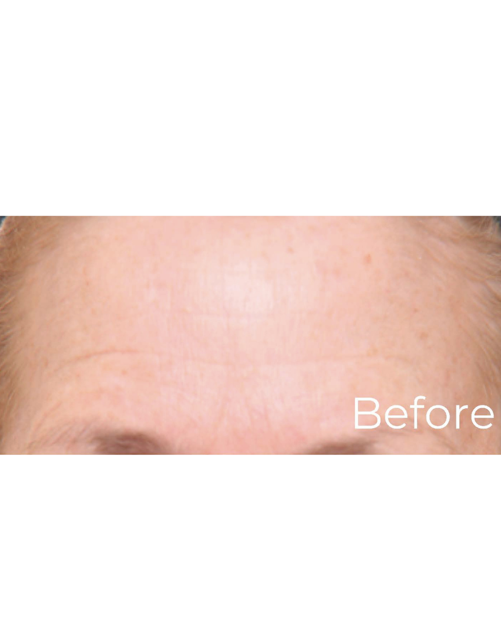 Before image